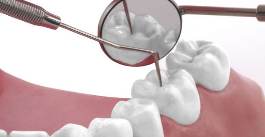 Dentisterie générale